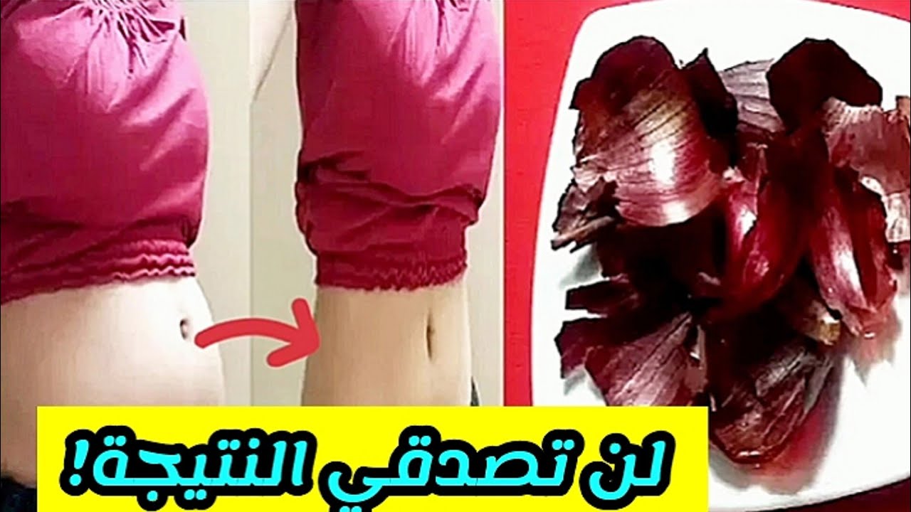 تخسيس الكرش