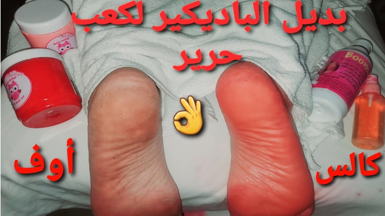 وصفة صودا الخبز لتقشير القدمين