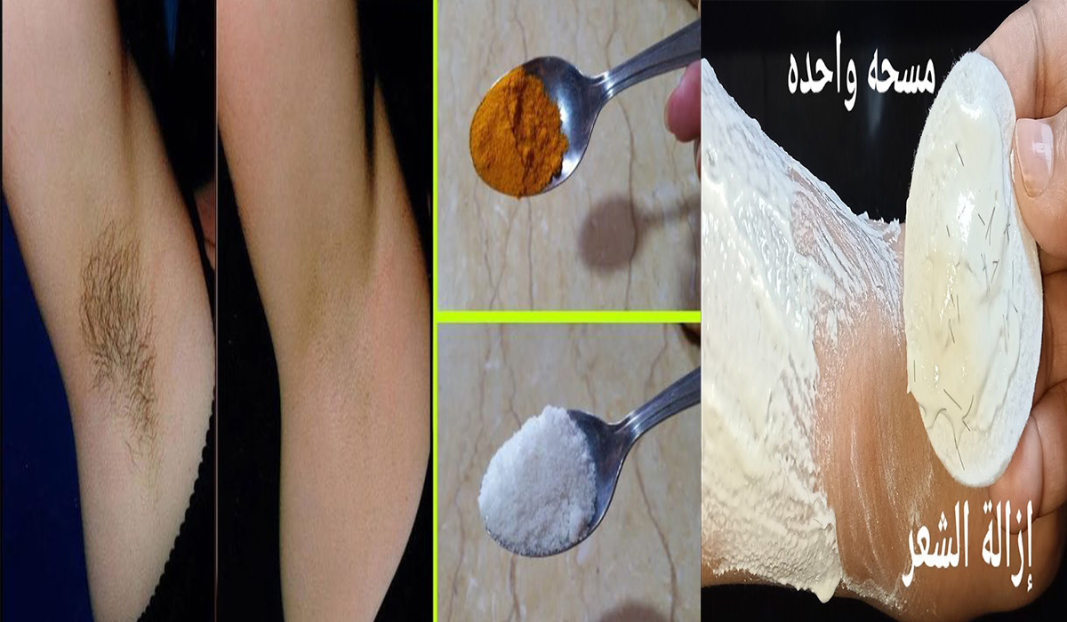 إزالة الشعر بدون ألم