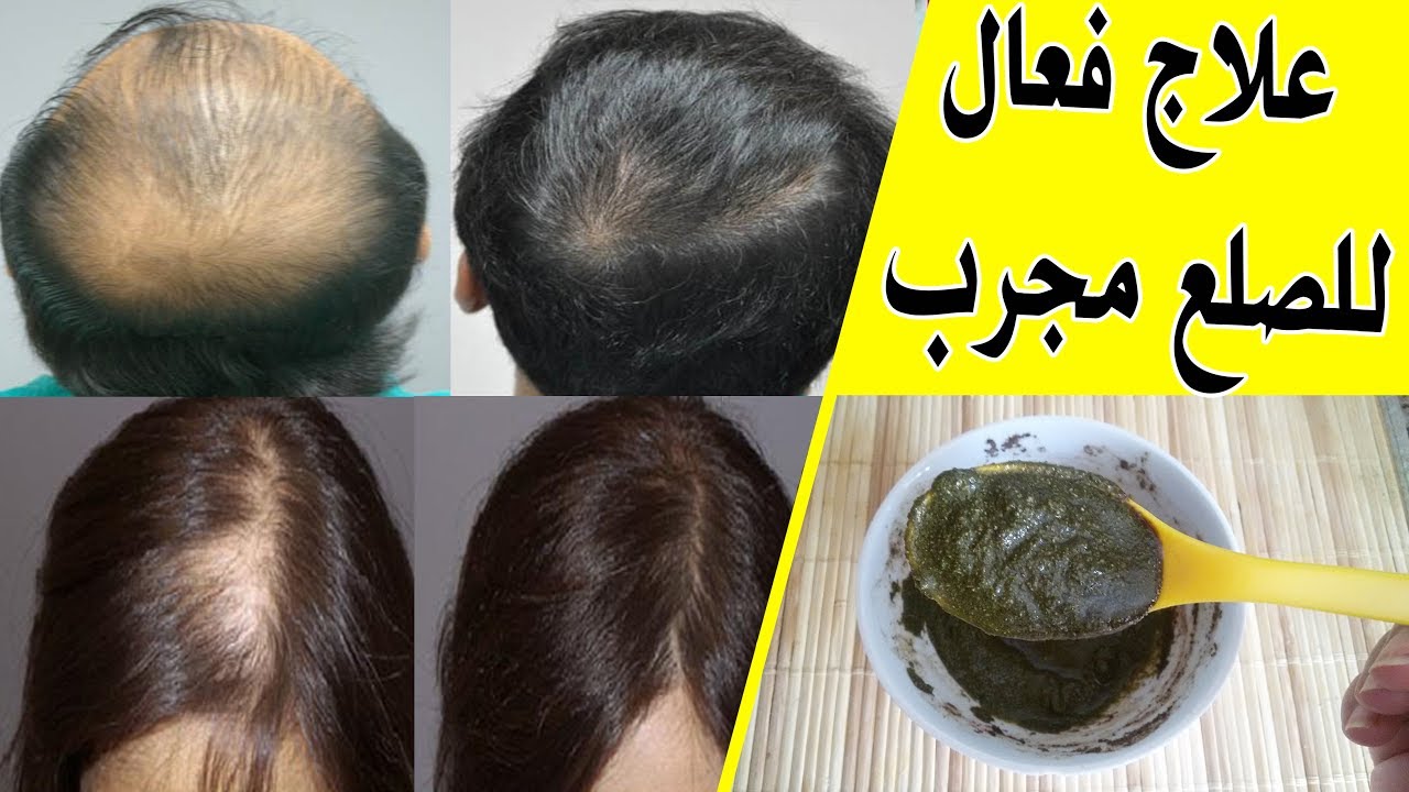 وصفة فريدة سيف النصر