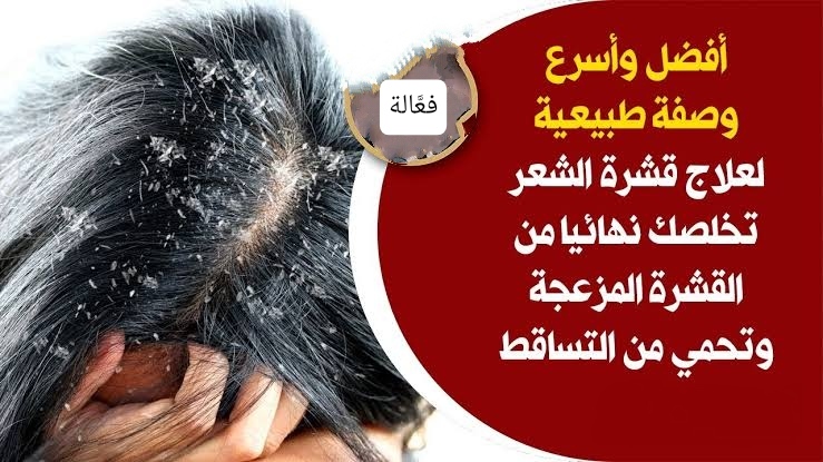 التخلص من القشرة