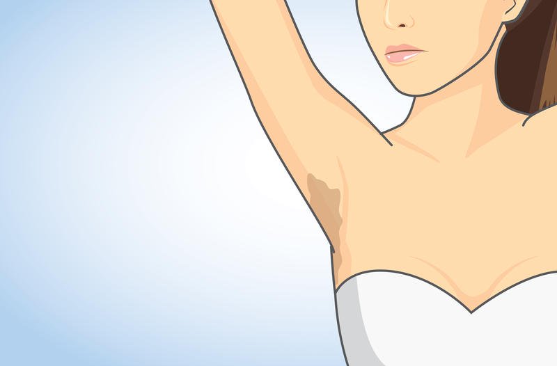 بمكونات طبيعية. 3 طرق منزلية تخلصك من سواد الإبطين