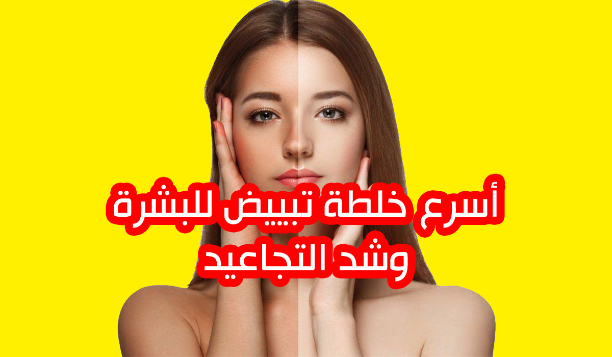 تبييض البشرة