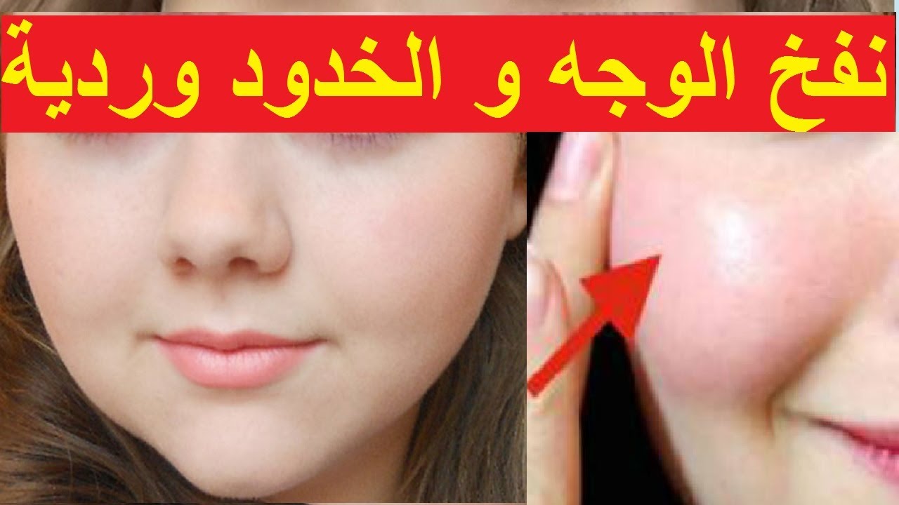 تسمين الخدود