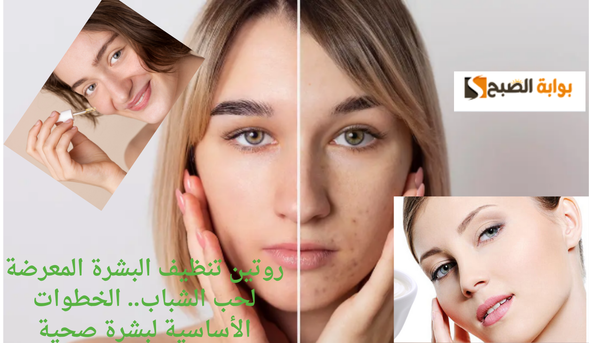 روتين تنظيف البشرة المعرضة لحب الشباب.. الخطوات الأساسية لبشرة صحية ومتوازنة