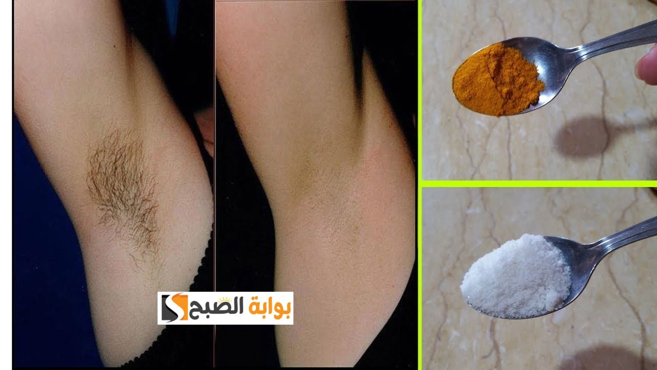 بديل الليزر هتوفري فلوس الجلسات .. وصفة سحرية لإزالة الشعر في منطقة الإبط والجسم في عشر دقايق بس "هتبقى فلة وشمعة منورة"