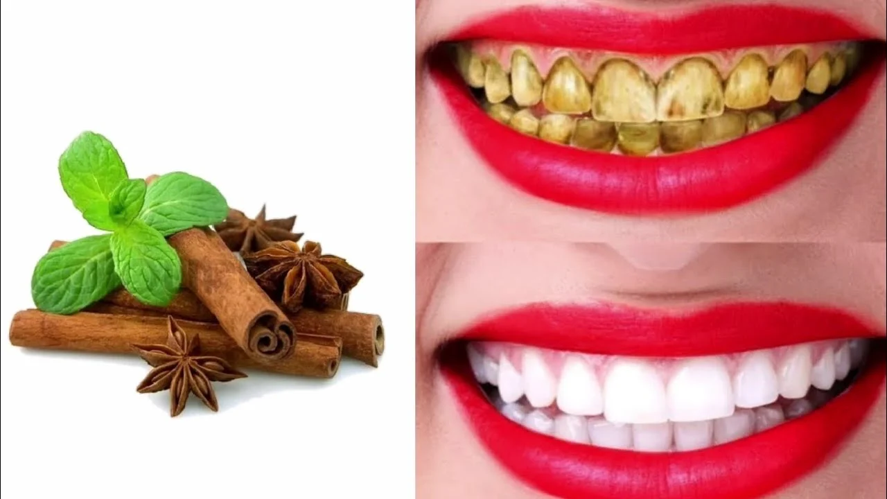 خلطة تبييض الأسنان بالقرنفل