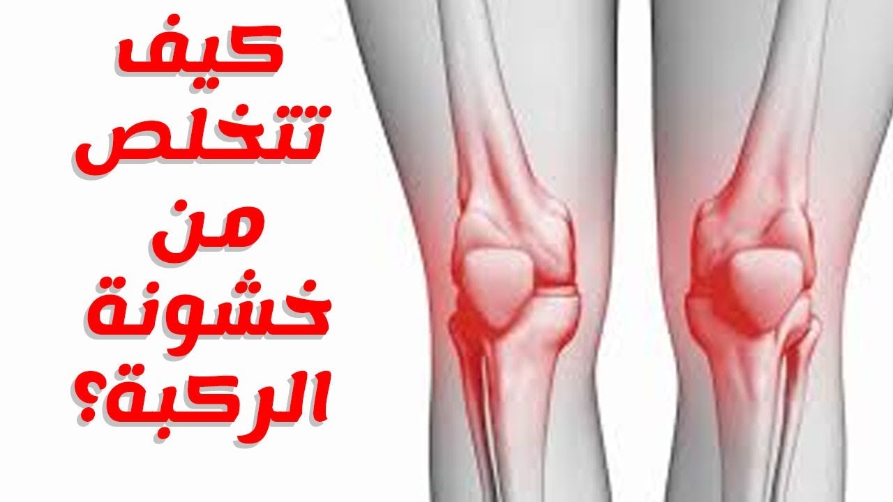 علاج خشونة الركبة