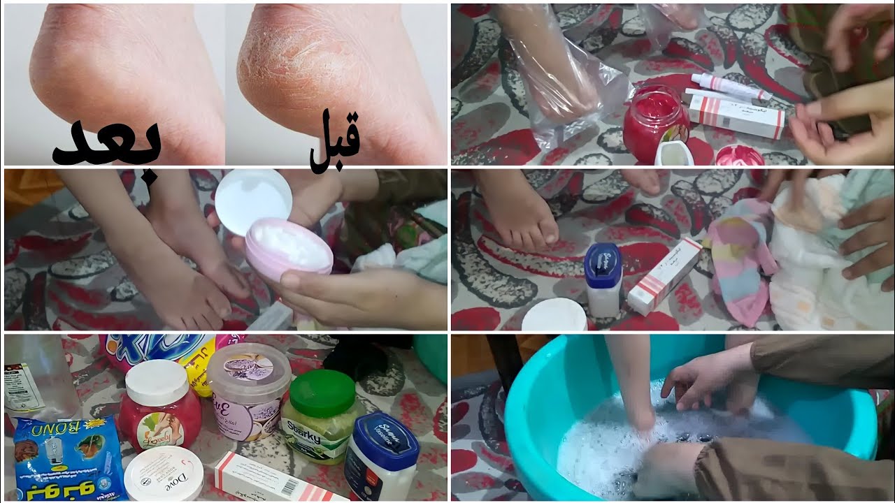 طريقة عمل باديكير في المنزل