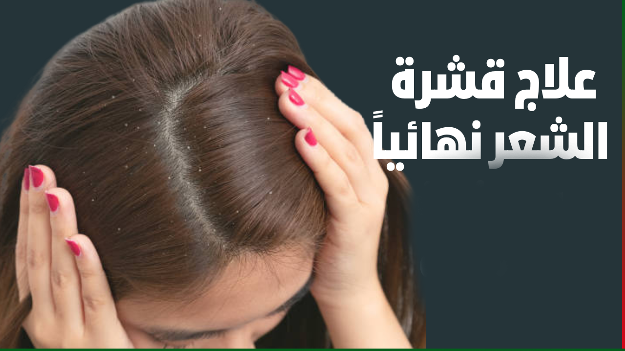 علاج قشرة الشعر نهائيا