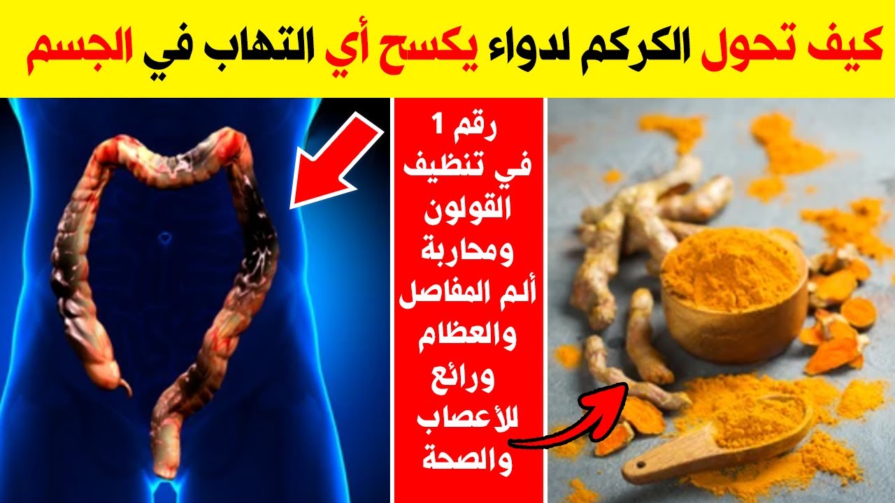 فوائد الكركم الصحية