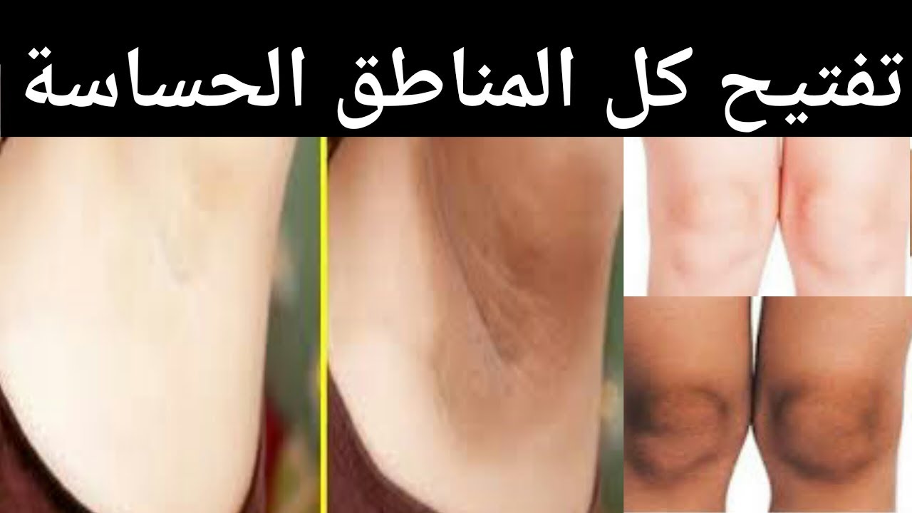 كريم تفتيح المناطق الحساسة شديدة السواد 8