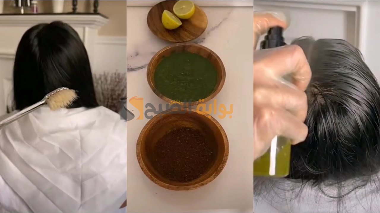 كيفية تنظيف فروة الرأس والتخلص من قشرة الشعر طبيعيا