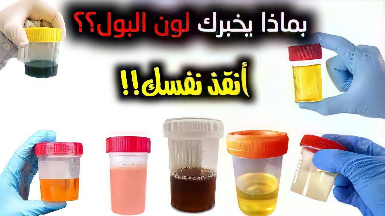 لون البول