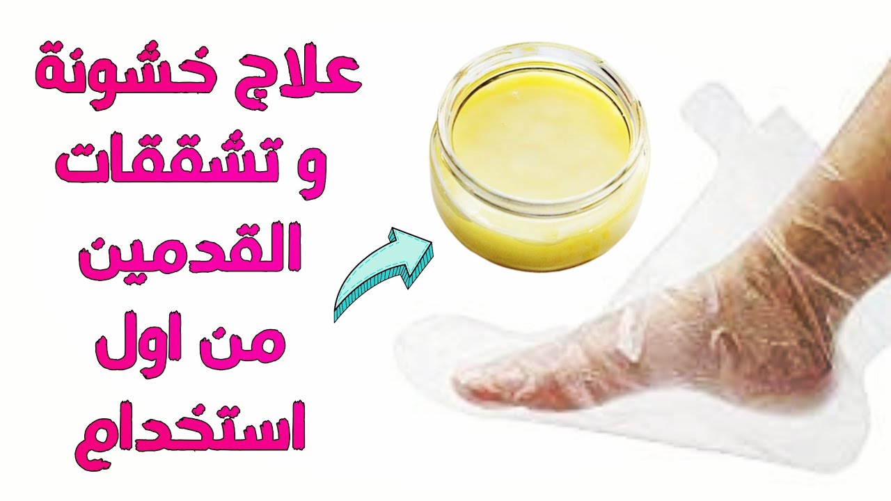مقشر سحري لتشققات القدم