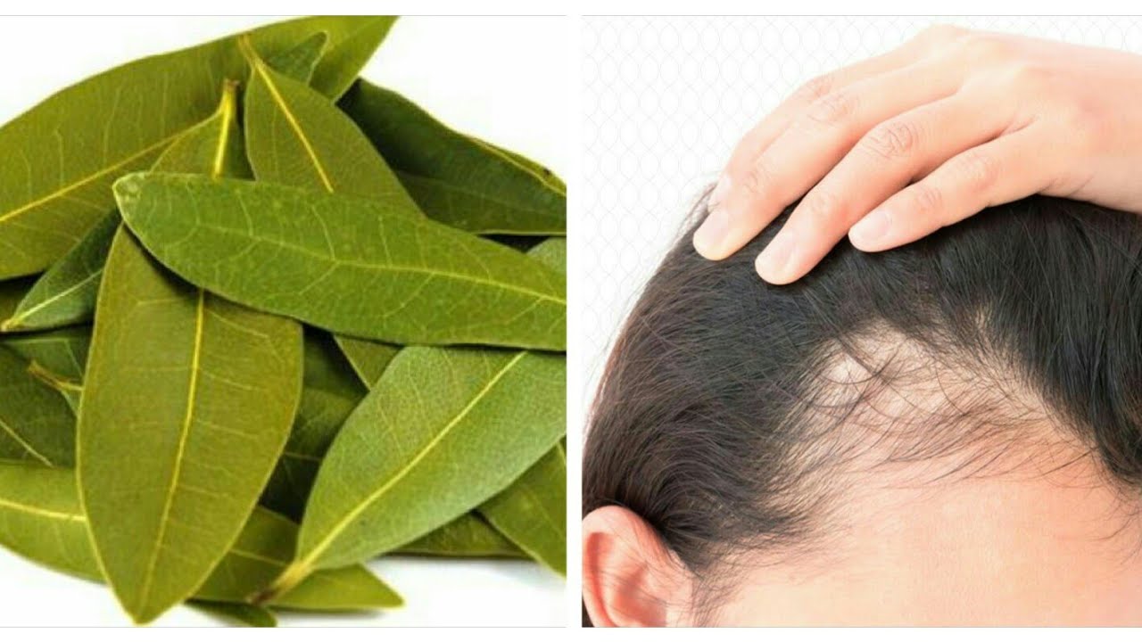 وصفة ورق الغار للشعر
