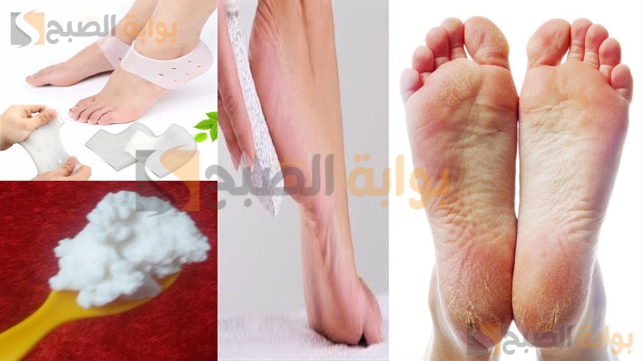 وصفات لترطيب القدمين وعلاج التشقق في وقت قصير جدا