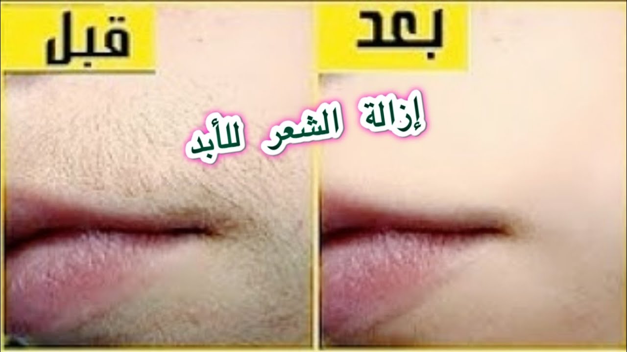 وصفة الملح الإنجليزي لإزالة شعر الوجه 1
