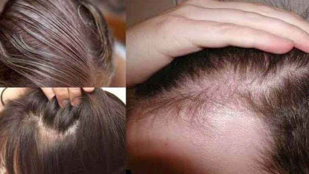  وصفة لتكثيف الشعر الخفيف وملء الفراغات