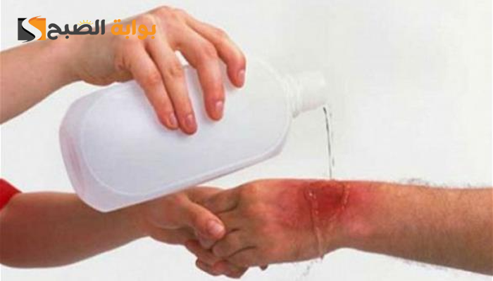 طريقة تنظيف الجروح بالصور وأهم الأخطاء الشائعة عند التنظيف