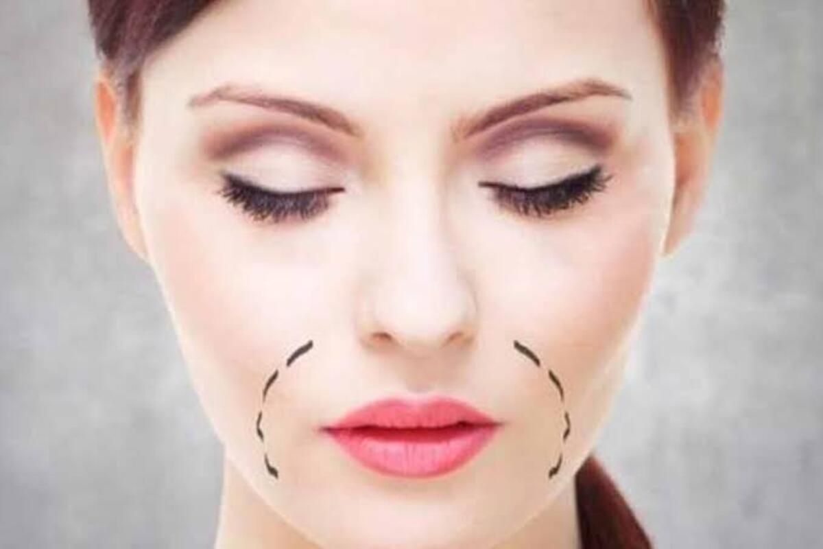 مشكلة الاسمرار حول الفم