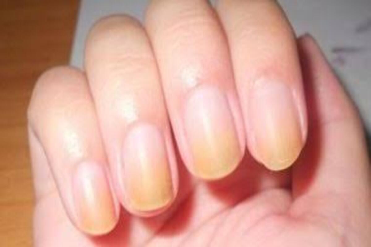 وصفات طبيعية لتبييض الأظافر بمكونات من المنزل