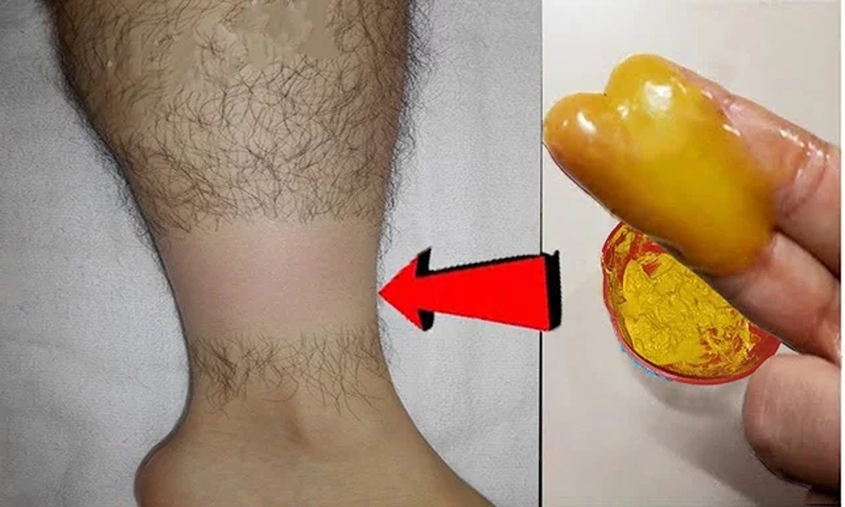 كيفية إزالة الشعر الزائد نهائيا بالملح والكركم