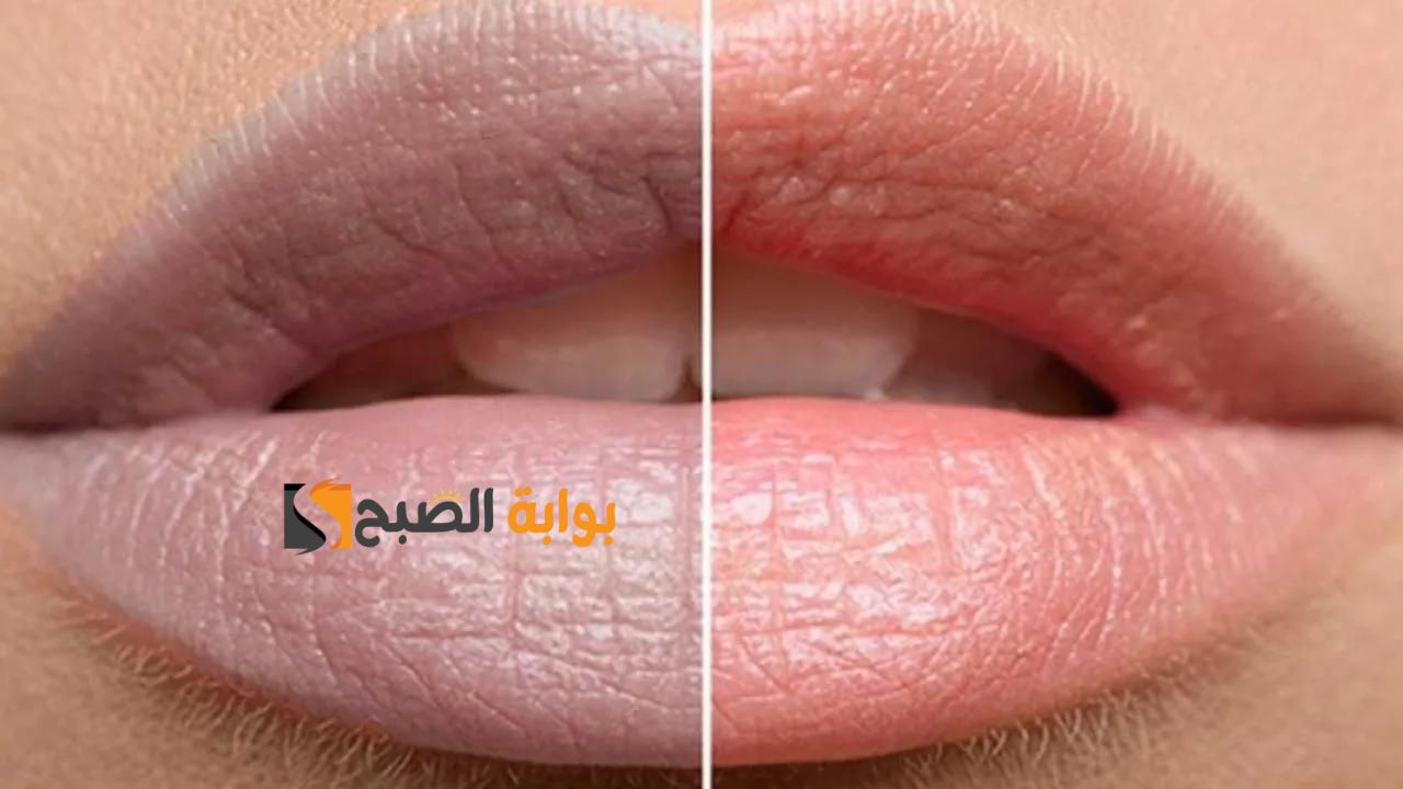 كأنك عملتي توريد .. وصفات طبيعية فعالة وقوية لعلاج مشكلة الشفايف الداكنة مع ماسك الفراولة انسي الغمقان" بياض ناصع وتحدي" 