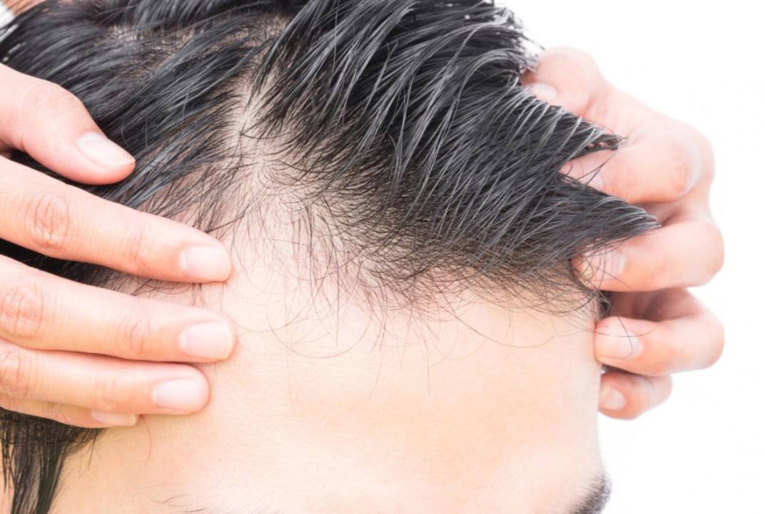 لإنبات الفراغات ووقف التساقط وصفات طبيعية لزيادة نمو الشعر اسرار الهنود لإطالة الشعر