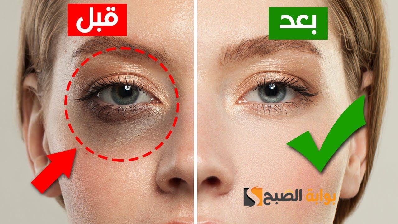 فايتك كتير لو متعرفيهاش .. وصفة الزبادي مع جل الصبار والعسل لإزالة الهالات السوداء حول العين ويقع البشرة " هتخلي عيونك شعاع من نور"