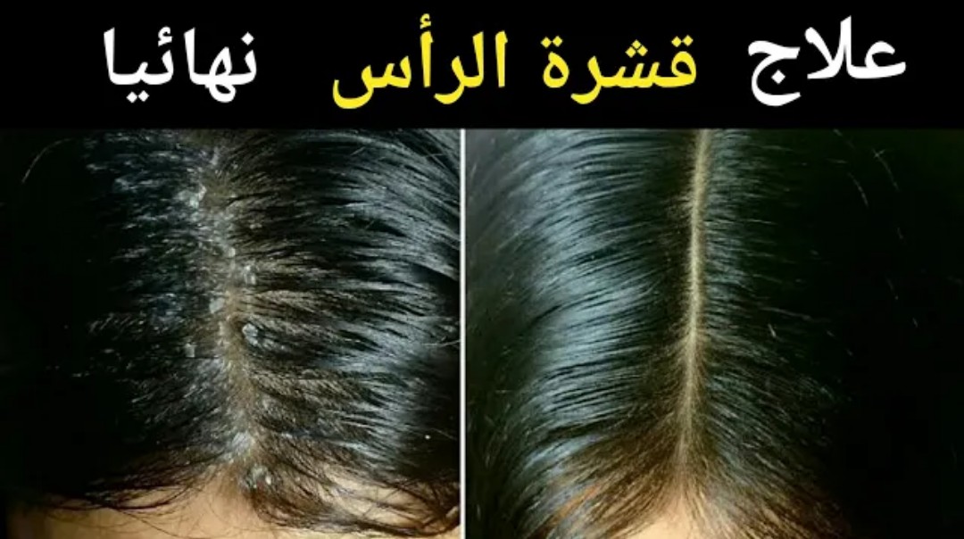 IMG ٢٠٢٢٠٣٠٦ ٠٥٢٥٥١