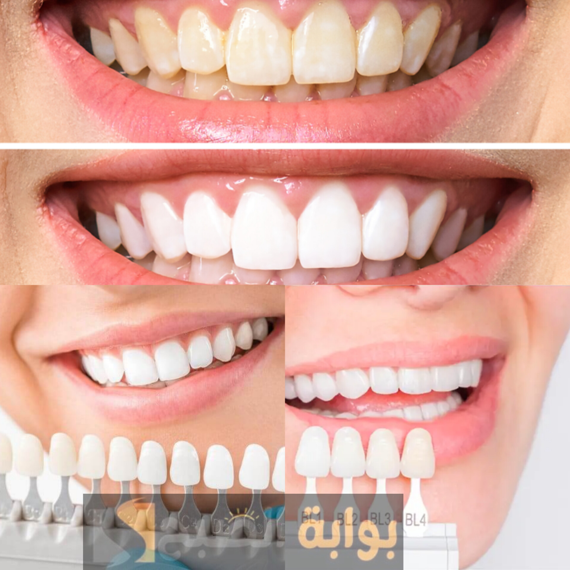 نصائح مهمة للحفاظ على الأسنان وتبييضها