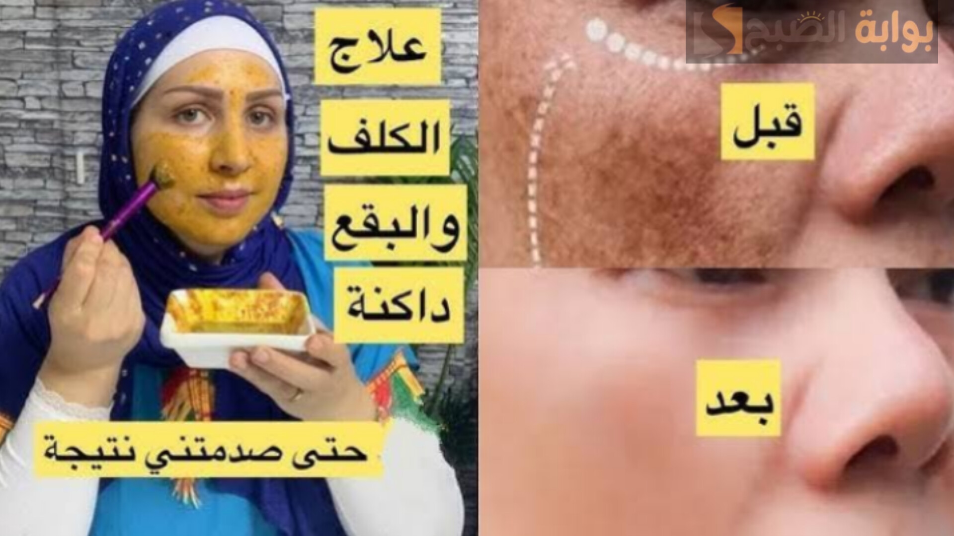 سيروم الترمس للوجه