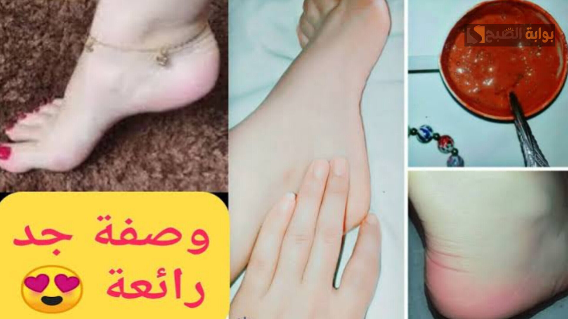 كريم إزالة تشققات الكعبين