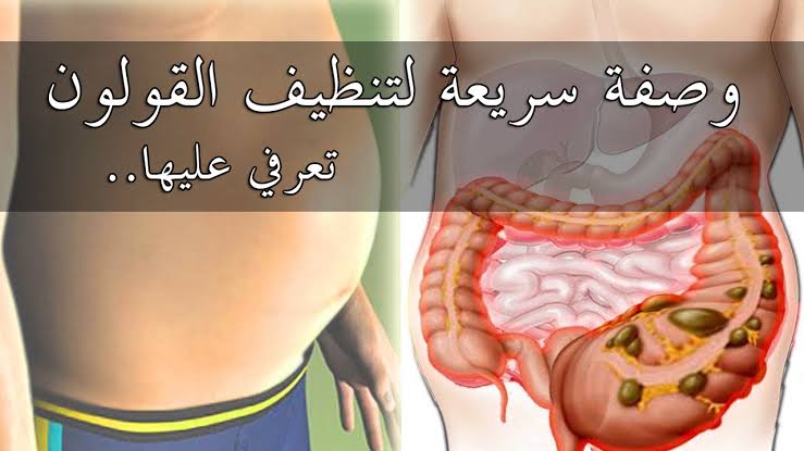 علاج الكولون العصبي وتنظيفه من البقايا المتحجرة وقُل وداعاً للانتفاخ والإمساك المزمن في 7 أيام