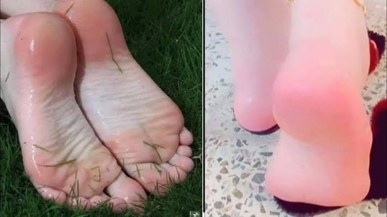 مقشر للقدمين واليدين