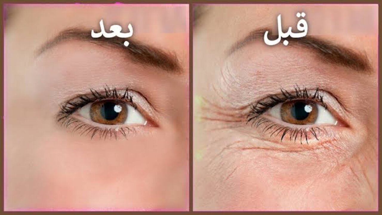 زيت الزيتون للتخلص من تجاعيد الوجه
