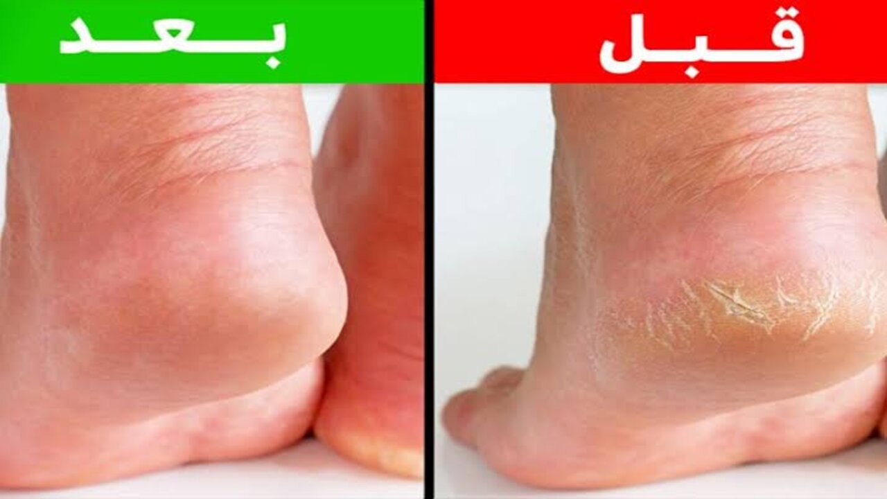 imaتثوثوges 6 1
