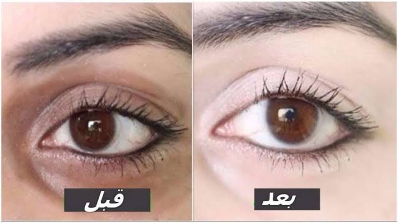 القهوة والعسل لعلاج الهالات السوداء