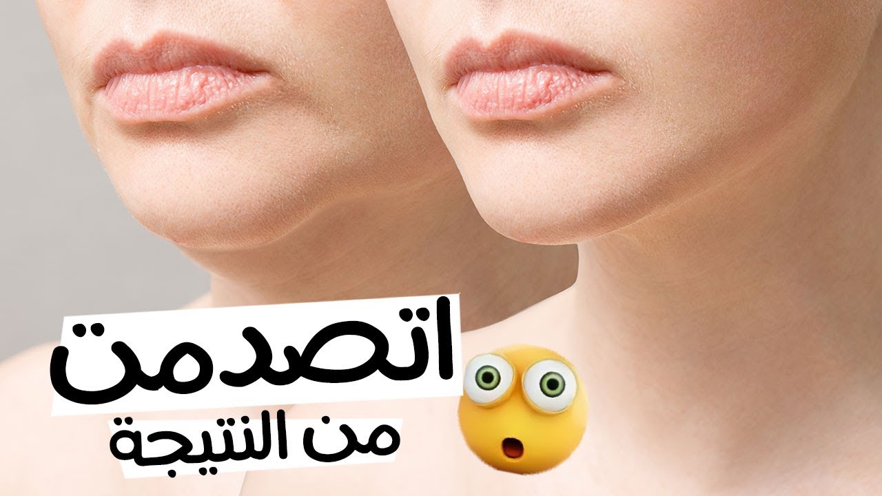 سيروم لشد الوجه