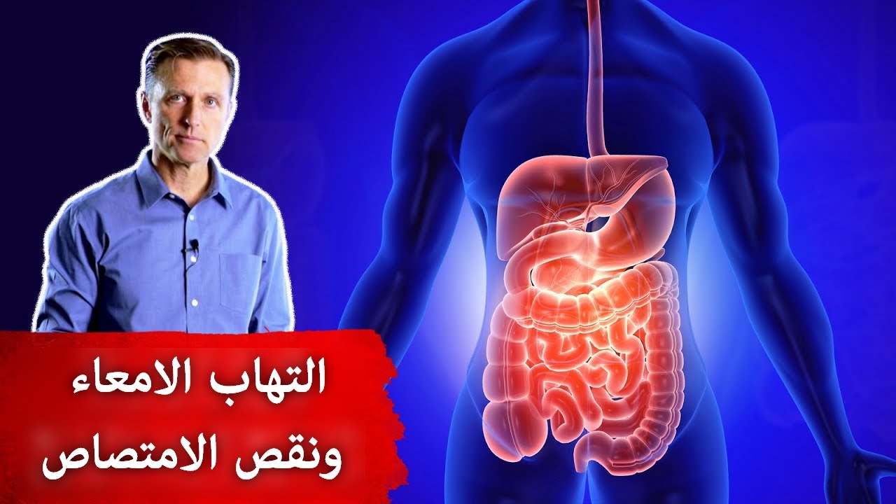 مشروب بسيط يعالج قرحة