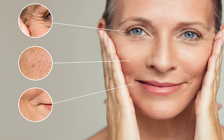 woman with different types of wrinkles