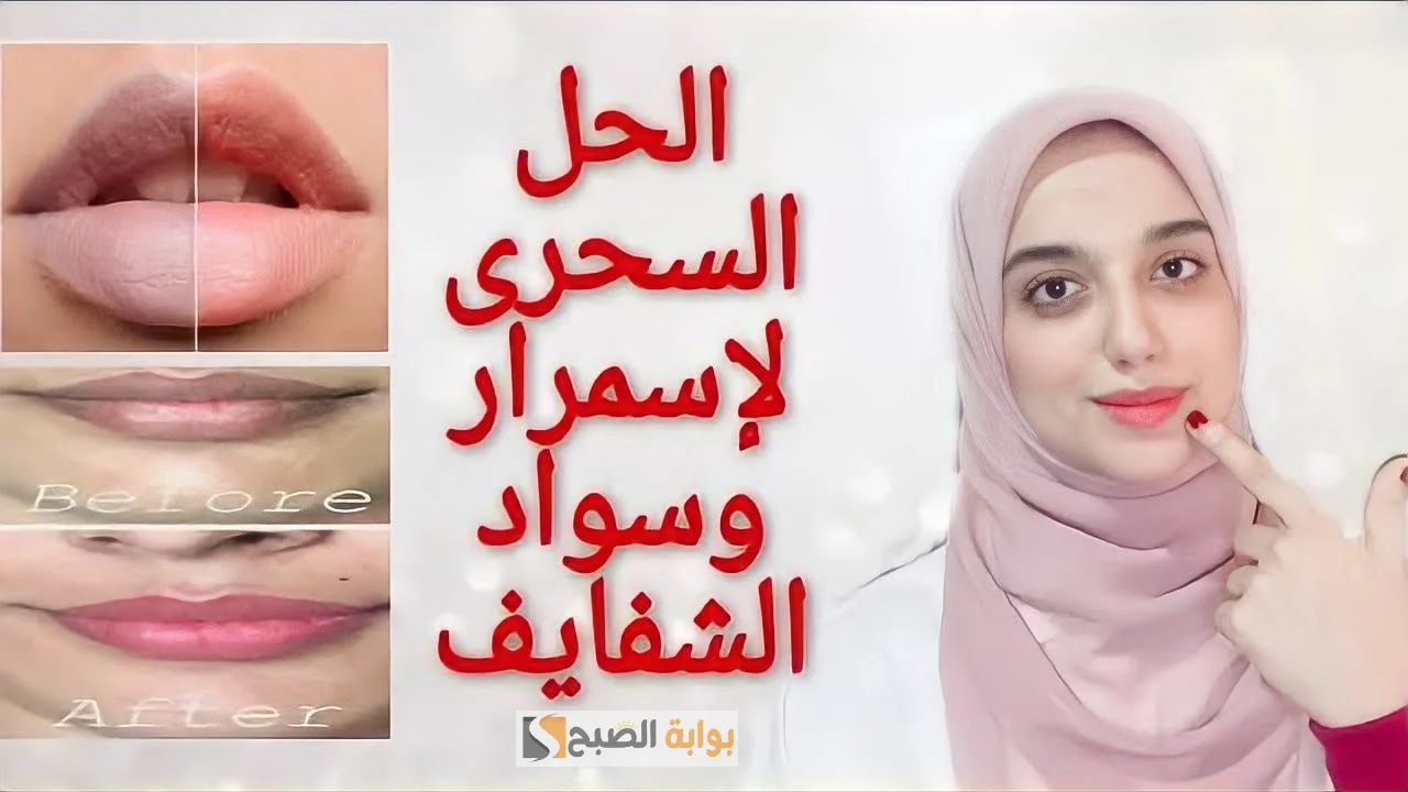 إزالة اسمرار الشفايف