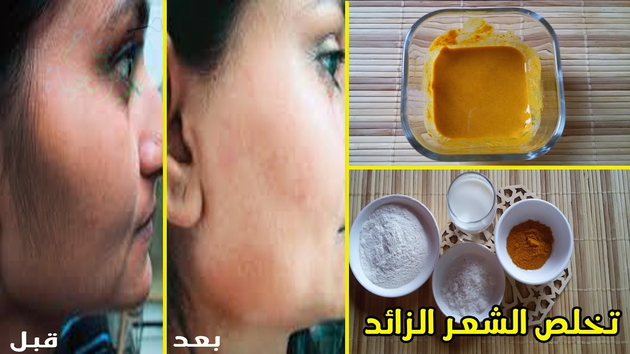 النشا والكركم لإزالة الشعر الزائد