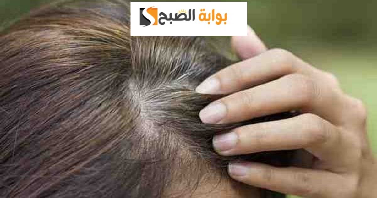 اخفاء الشيب نهائيا مجرب