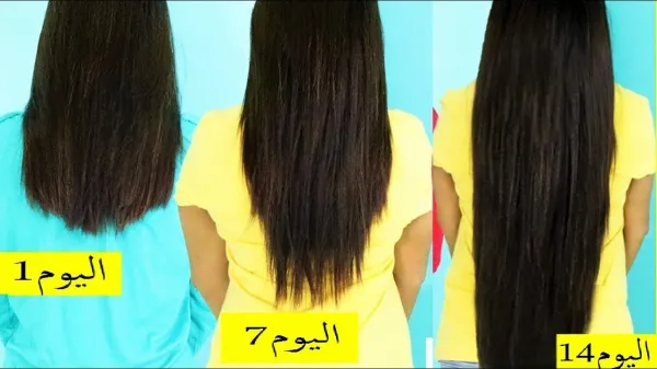 اصنعي بنفسك بخاخ القرنفل وإكليل الجبل وتمتعي بشعر طويل وكثيف بدون تساقط نهائيًا