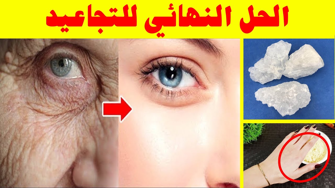 شد تجاعيد الجبهة وحول العينين بهذه الوصفة الخارقة والنتيجة من أول استعمال