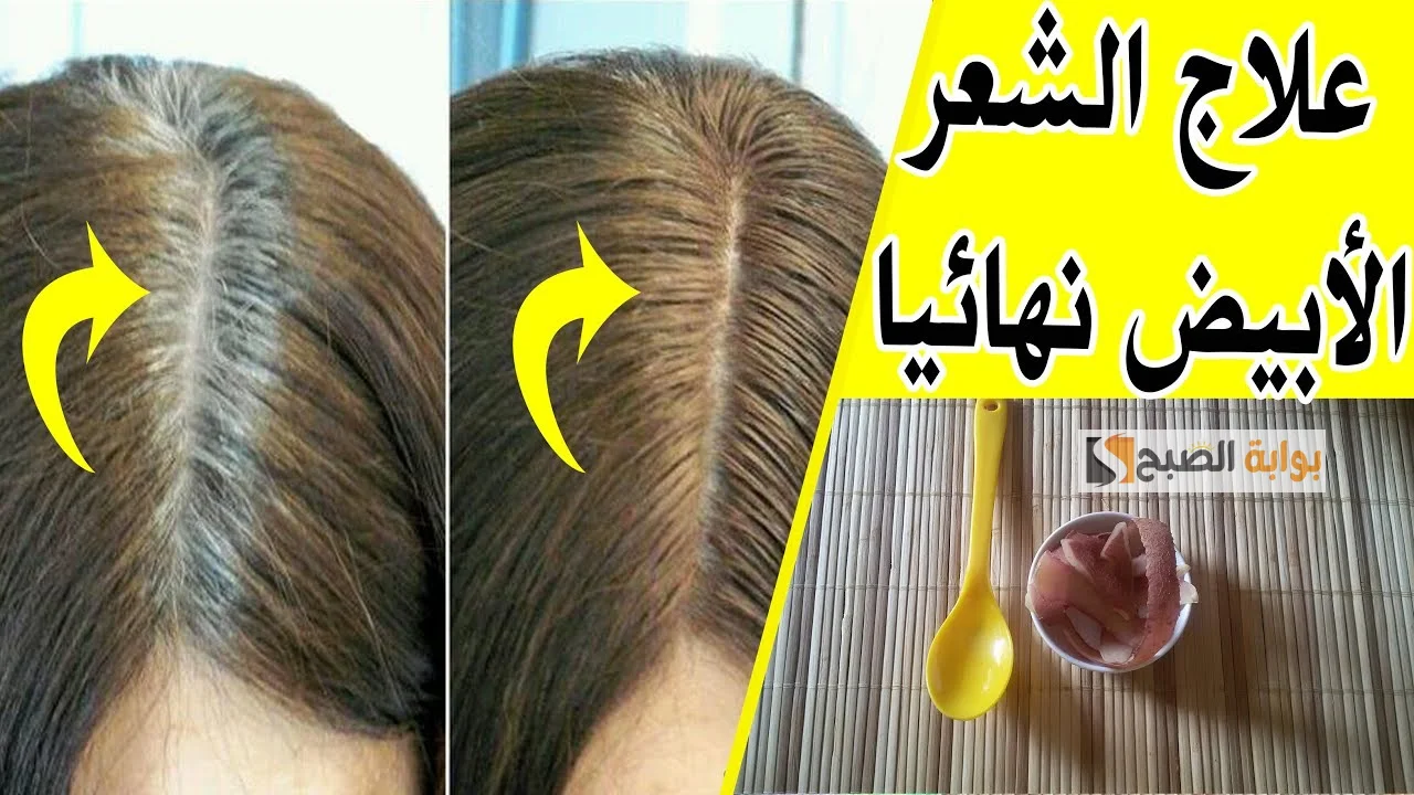 التخلص من الشعر الأبيض التخلص من الشعر الأبيض