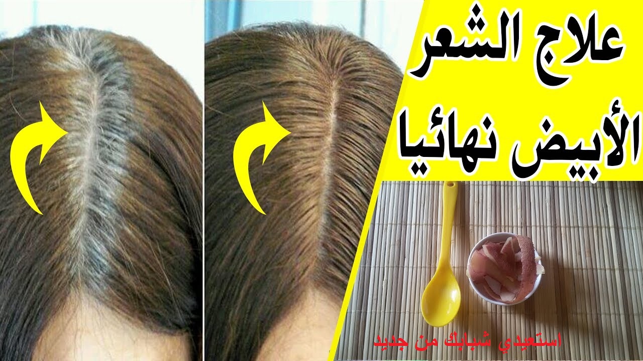 التخلص من الشيب نهائيا