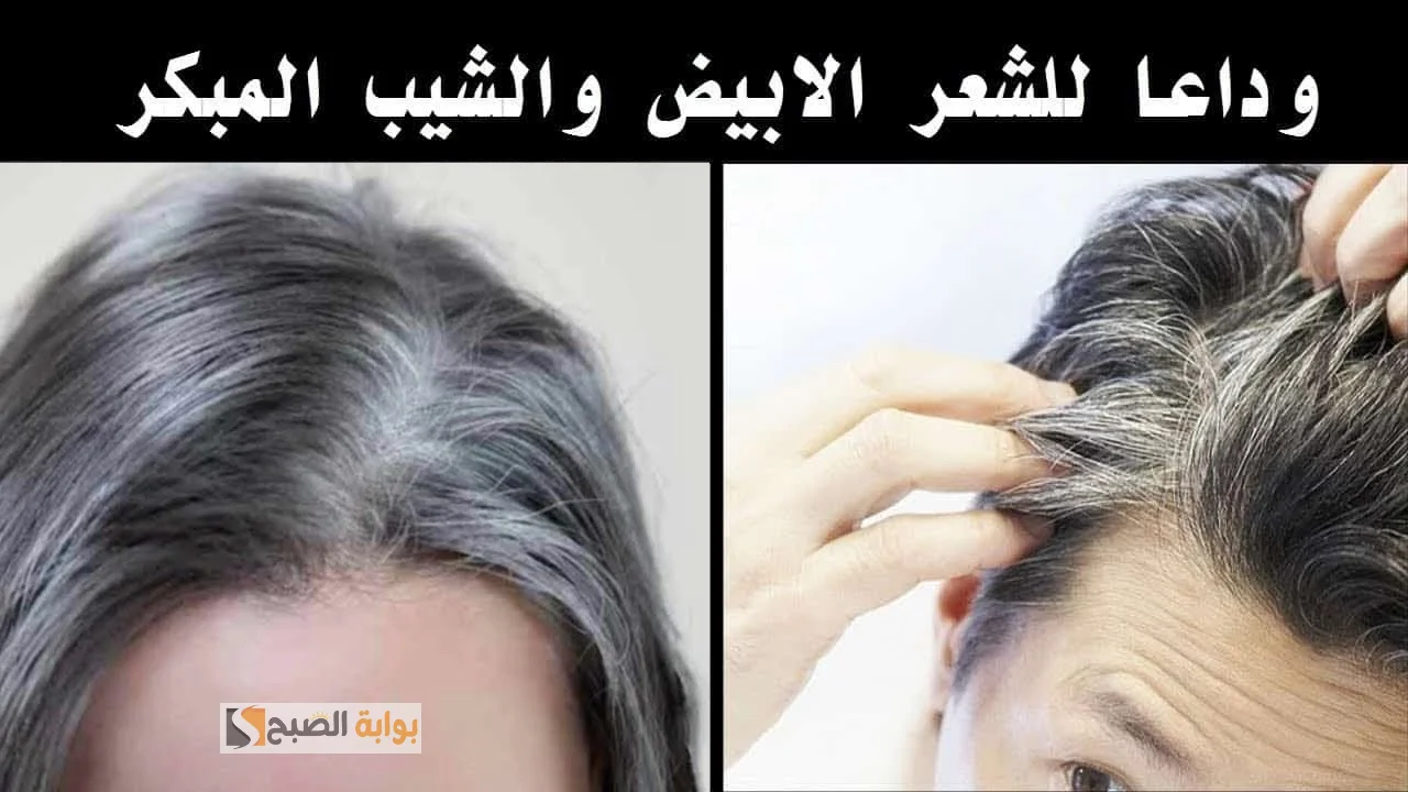 القضاء على الشعر الأبيض